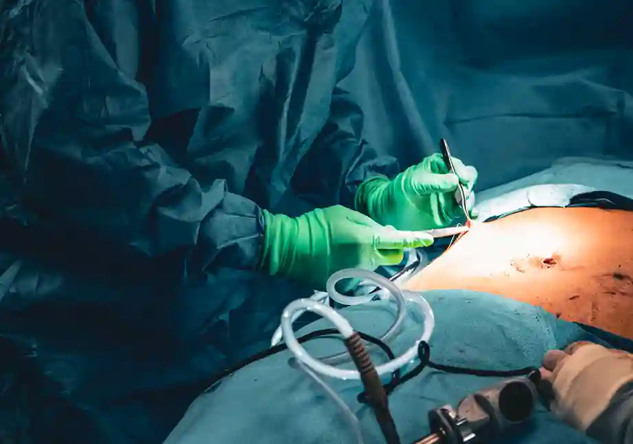 Spine Surgery - Neurosurgery